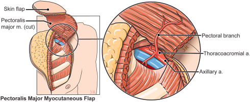 1 s2.0 s2214854x20300431 fx1