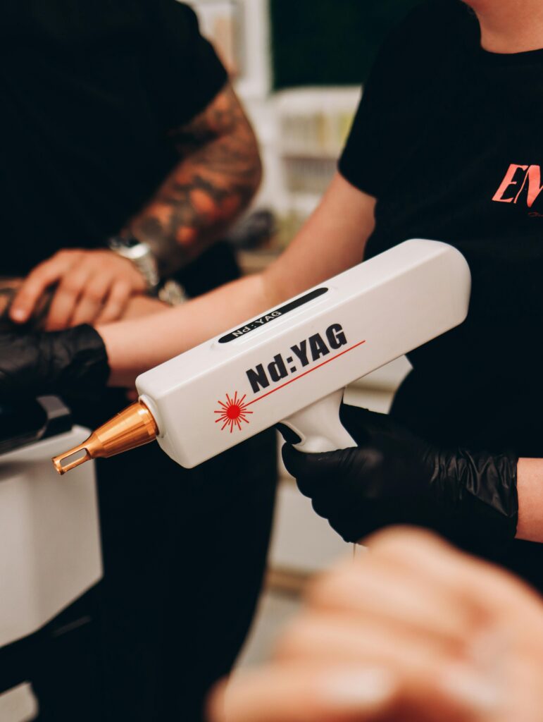 Close-up of Nd:YAG laser used in tattoo removal procedure at a clinic in Poland.