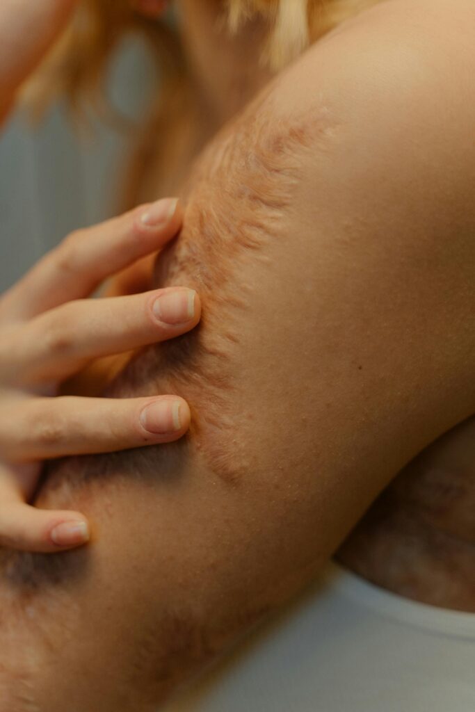 Detailed view of an arm showing natural scars and skin texture, emphasizing body positivity.